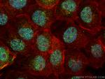 ZNF521 Antibody in Immunocytochemistry (ICC/IF)