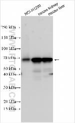 ZNF521 Antibody in Western Blot (WB)