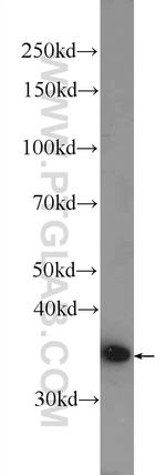 AIDA Antibody in Western Blot (WB)