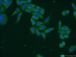 RPAP3 Antibody in Immunocytochemistry (ICC/IF)