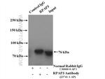 RPAP3 Antibody in Immunoprecipitation (IP)