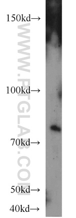 RPAP3 Antibody in Western Blot (WB)