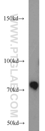 RPAP3 Antibody in Western Blot (WB)