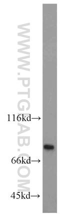 RPAP3 Antibody in Western Blot (WB)