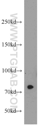 RPAP3 Antibody in Western Blot (WB)