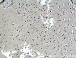 ASCL1 Antibody in Immunohistochemistry (Paraffin) (IHC (P))