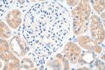 TPCN1 Antibody in Immunohistochemistry (Paraffin) (IHC (P))