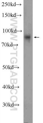 TPCN1 Antibody in Western Blot (WB)