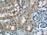 RSK2 Antibody in Immunohistochemistry (Paraffin) (IHC (P))