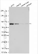 UGT1A6 Antibody in Western Blot (WB)