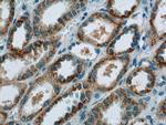 CCDC27 Antibody in Immunohistochemistry (Paraffin) (IHC (P))