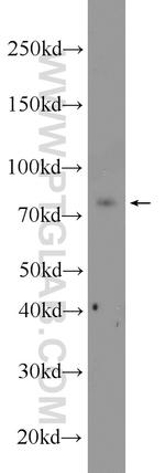 CCDC27 Antibody in Western Blot (WB)