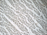ADM2 Antibody in Immunohistochemistry (Paraffin) (IHC (P))