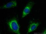 PRELP Antibody in Immunocytochemistry (ICC/IF)