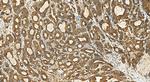 PRELP Antibody in Immunohistochemistry (Paraffin) (IHC (P))