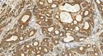 PRELP Antibody in Immunohistochemistry (Paraffin) (IHC (P))
