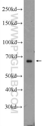 AKNA Antibody in Western Blot (WB)