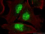 PTPRU Antibody in Immunocytochemistry (ICC/IF)