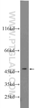 ZNF271 Antibody in Western Blot (WB)