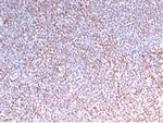 ALK (Anaplastic Lymphoma Kinase)/CD246 Monoclonal Antibody (rALK1/1504)