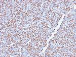 ALK (Anaplastic Lymphoma Kinase)/CD246 Recombinant Rabbit Monoclonal Antibody (ALK1/2766R)