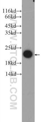 FATE1 Antibody in Western Blot (WB)