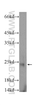 FATE1 Antibody in Western Blot (WB)