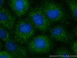 KLK7 Antibody in Immunocytochemistry (ICC/IF)