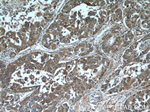 RSRC1 Antibody in Immunohistochemistry (Paraffin) (IHC (P))