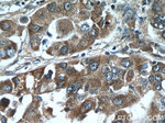 RSRC1 Antibody in Immunohistochemistry (Paraffin) (IHC (P))