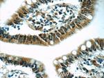RSRC1 Antibody in Immunohistochemistry (Paraffin) (IHC (P))