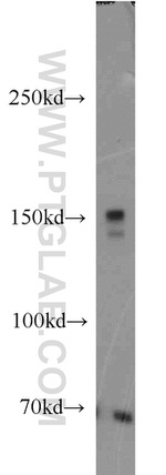 PRDM10 Antibody in Western Blot (WB)