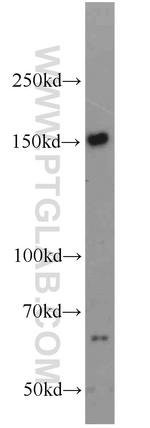 PRDM10 Antibody in Western Blot (WB)
