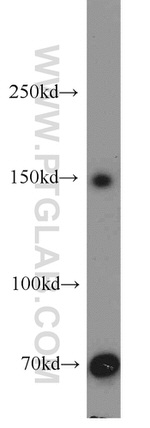PRDM10 Antibody in Western Blot (WB)