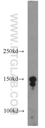PRDM10 Antibody in Western Blot (WB)
