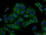 IREB2 Antibody in Immunocytochemistry (ICC/IF)