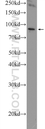 IREB2 Antibody in Western Blot (WB)