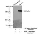 CLIP1 Antibody in Immunoprecipitation (IP)