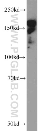 CLIP1 Antibody in Western Blot (WB)