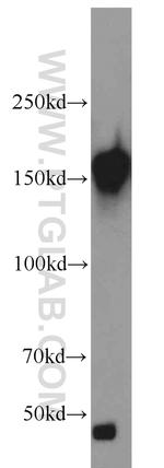 CLIP1 Antibody in Western Blot (WB)