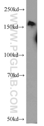 CLIP1 Antibody in Western Blot (WB)