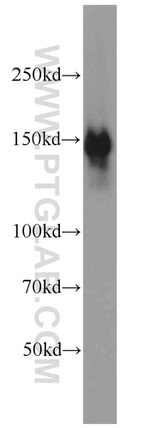 CLIP1 Antibody in Western Blot (WB)