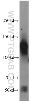 CLIP1 Antibody in Western Blot (WB)