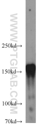 CLIP1 Antibody in Western Blot (WB)