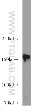 CLIP1 Antibody in Western Blot (WB)