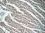 NDUFC1 Antibody in Immunohistochemistry (Paraffin) (IHC (P))