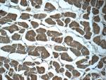 NDUFC1 Antibody in Immunohistochemistry (Paraffin) (IHC (P))