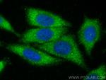 SCF Antibody in Immunocytochemistry (ICC/IF)