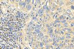 PCDHGC5 Antibody in Immunohistochemistry (Paraffin) (IHC (P))