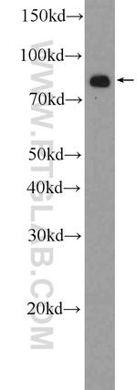 BCHE Antibody in Western Blot (WB)